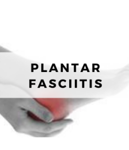 Plantar fasciitis heel and arch pain footsmart podiatry