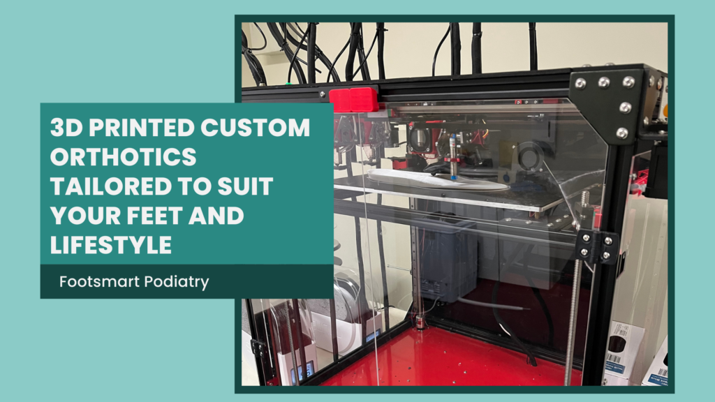 3D printed Custom orthotics