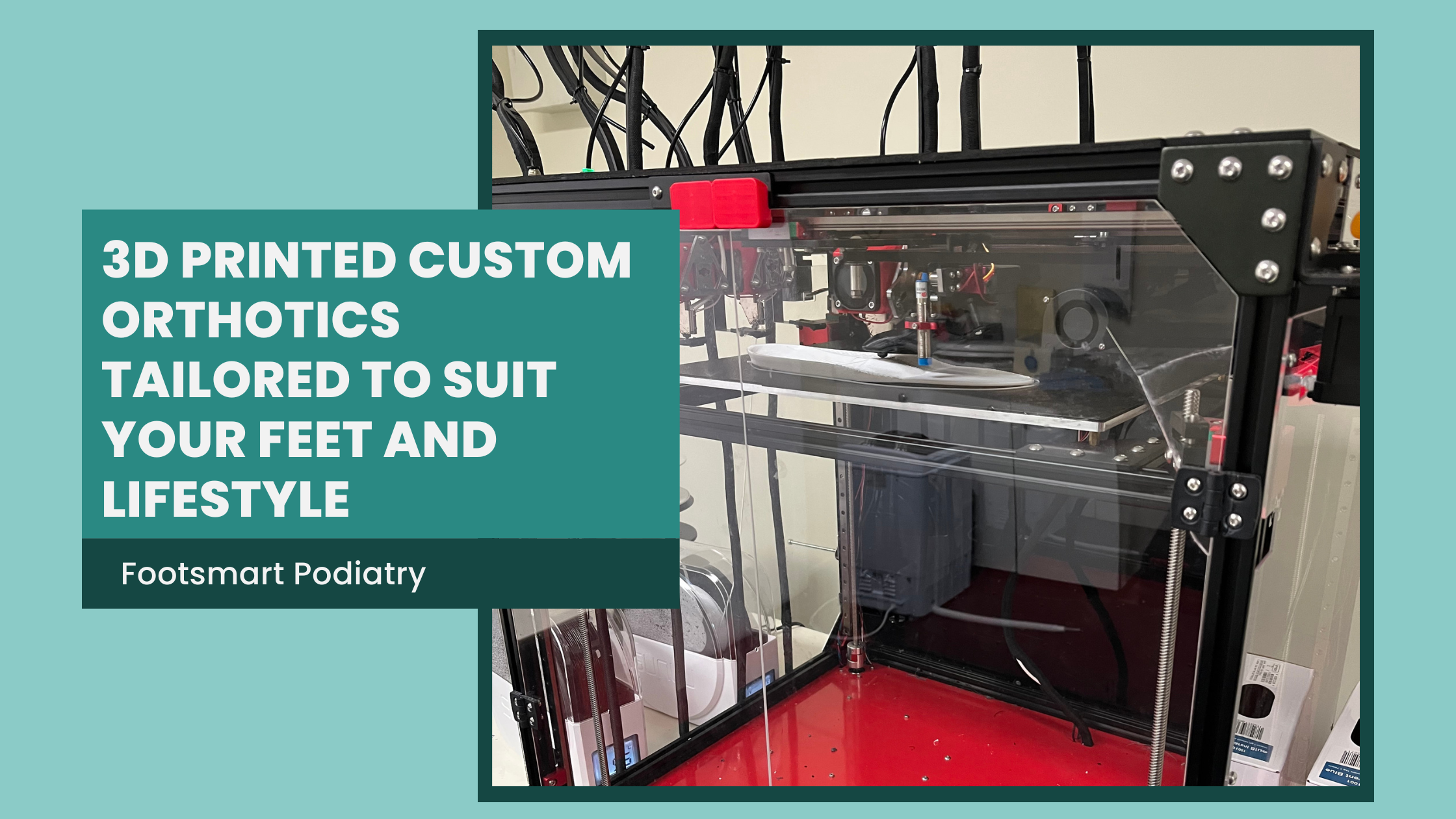 How 3D Printed Custom Orthotics Can Help You Stay Active on the Sunshine Coast